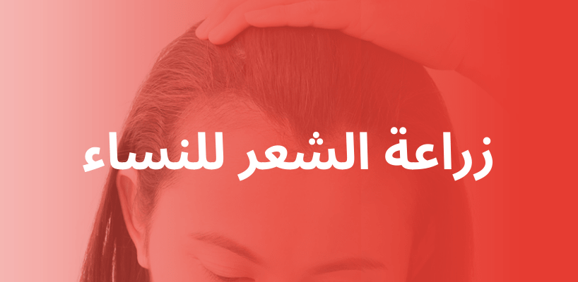 زراعة الشعر للنساء