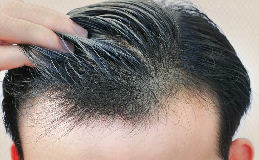 زراعة الشعر في اسطنبول