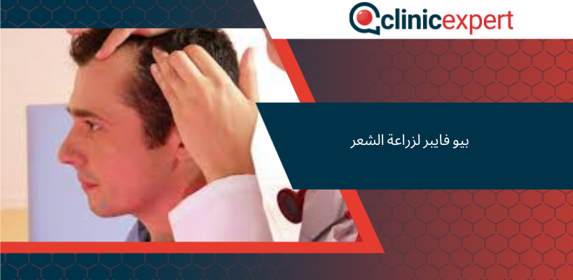 بيو فايبر لزراعة الشعر‎