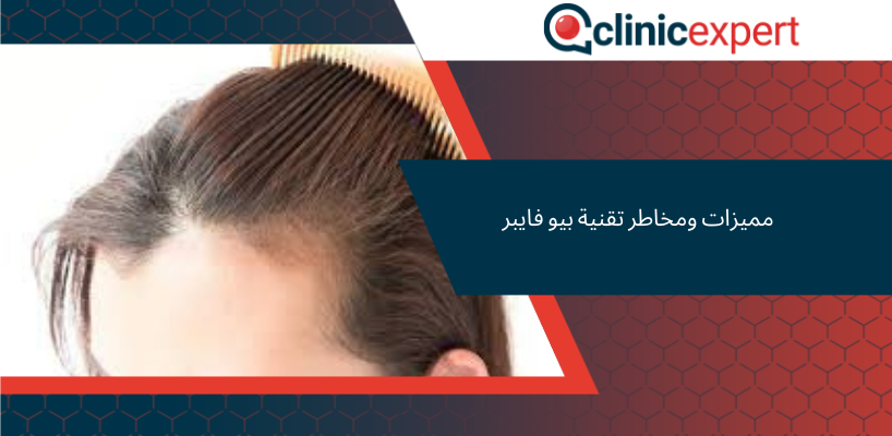 مميزات ومخاطر تقنية بيو فايبر