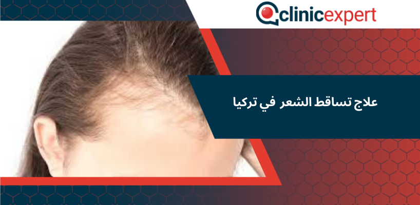 علاج تساقط الشعر في تركيا