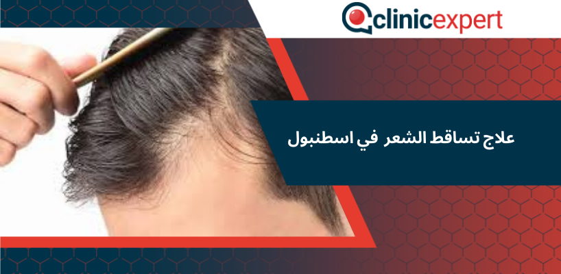 علاج تساقط الشعر في اسطنبول
