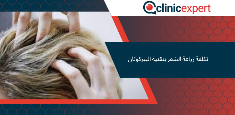 تكلفة زراعة الشعر بتقنية البيركوتان