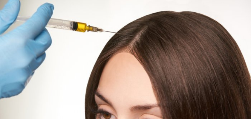 تكلفة زراعة الشعر بالخلايا الجذعية