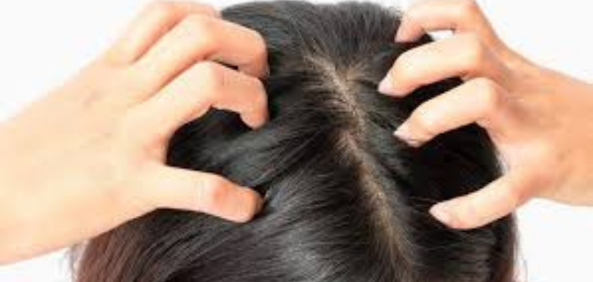 زراعة الشّعر في جدّة ClinicExpert خدمات زراعة الشعر والرعاية الصحية