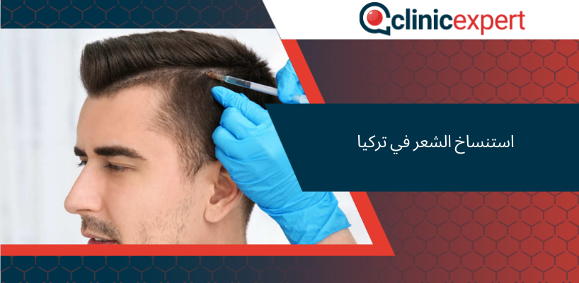 استنساخ الشعر في تركيا