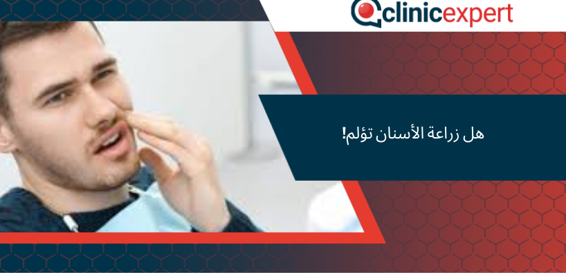 هل زراعة الأسنان تؤلم Clinicexpert خدمات زراعة الشعر والرعاية الصحية 