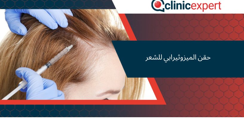 حقن الميزوثيرابي للشعر