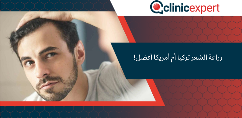زراعة الشعر تركيا