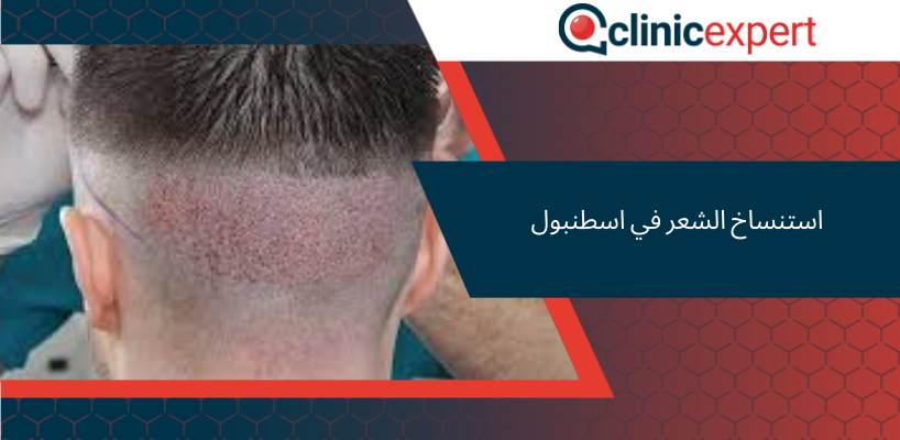 استنساخ الشعر في اسطنبول