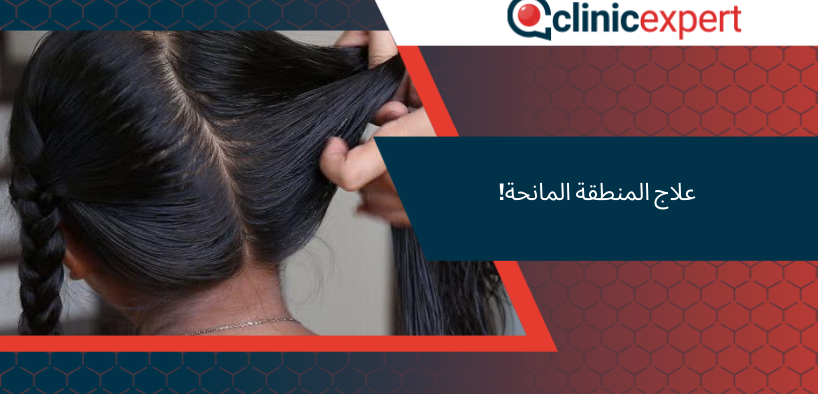 علاج المنطقة المانحة!