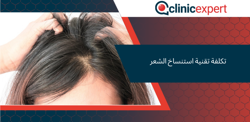 تكلفة استنساخ الشعر
