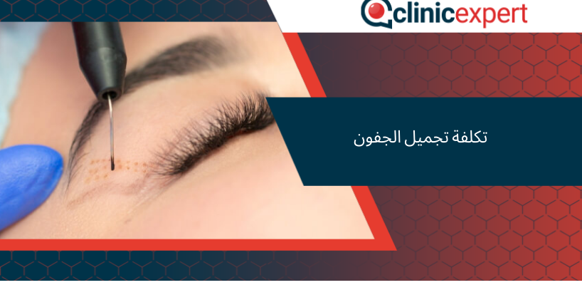 تكلفة تجميل الجفون