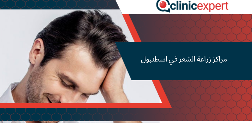 مراكز زراعة الشعر في اسطنبول