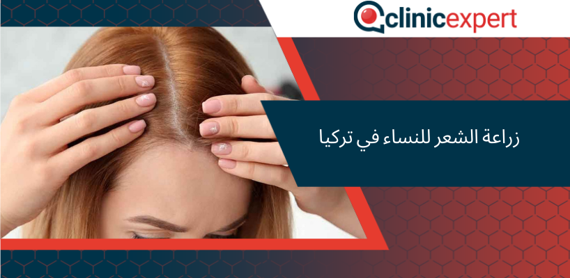 زراعة الشعر للنساء في تركيا