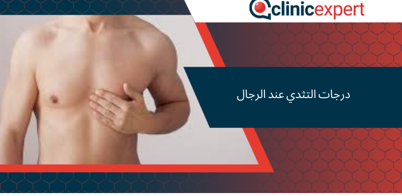 درجات التثدي عند الرجال