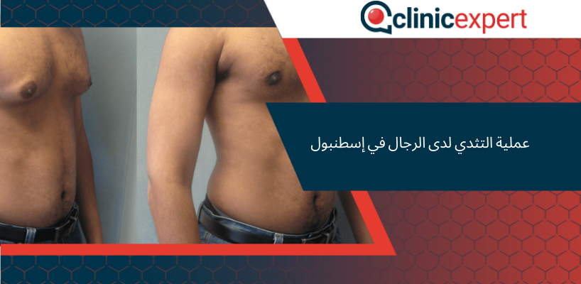 عملية التثدي لدى الرجال في إسطنبول