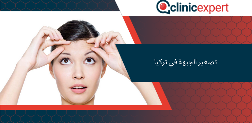 تصغير الجبهة في تركيا