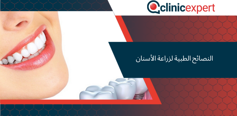 النصائح الطبية لزراعة الأسنان