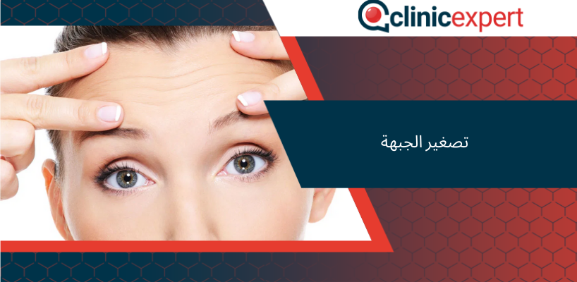 تصغير الجبهة