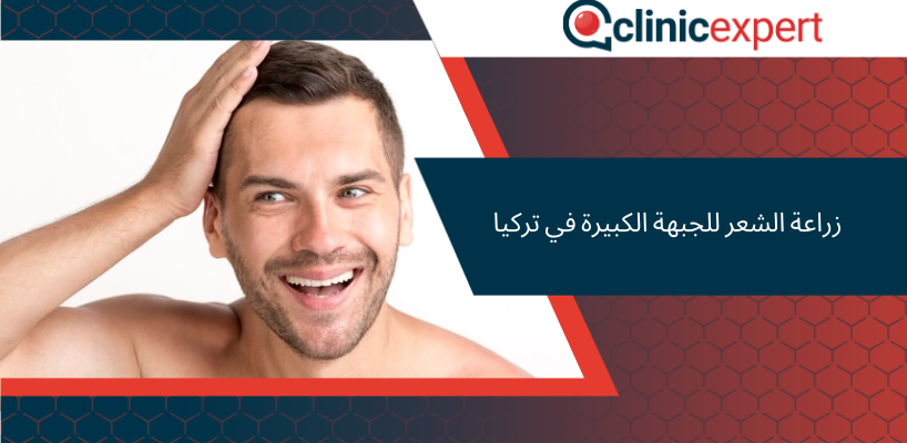 زراعة الشعر للجبهة الكبيرة في تركيا