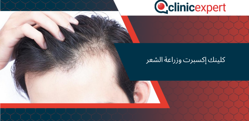 كلينك إكسبرت وزراعة الشعر