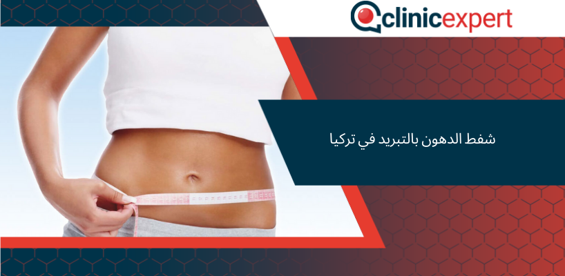 شفط الدهون بالتبريد في تركيا