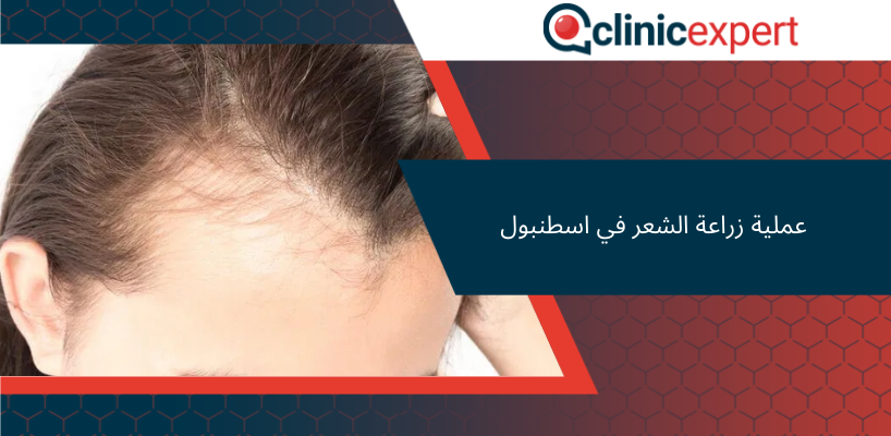 عملية زراعة الشعر في اسطنبول