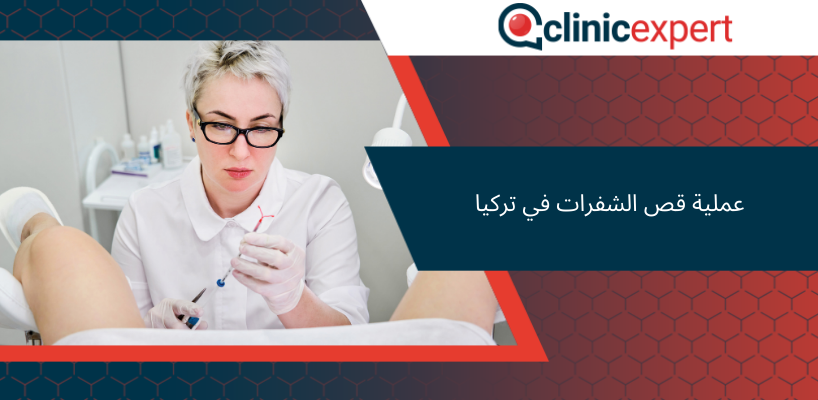 عملية قص الشفرات في تركيا
