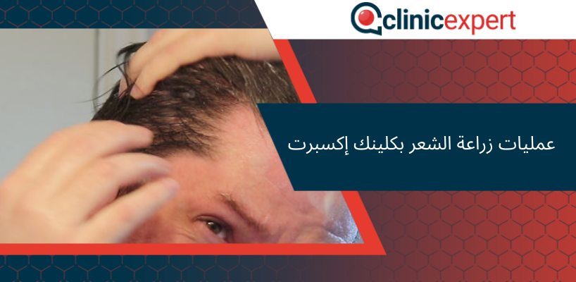 عمليات زراعة الشعر بكلينك إكسبرت