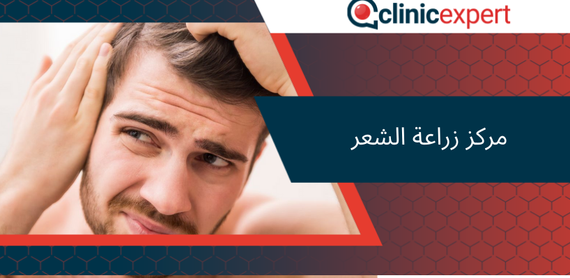 مركز زراعة الشعر