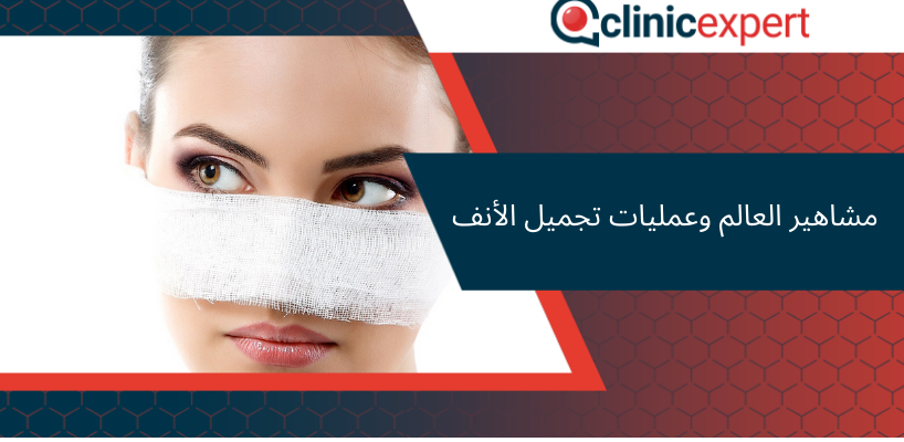 مشاهير العالم وعمليات تجميل الأنف