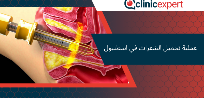 عملية تجميل الشفرات في اسطنبول