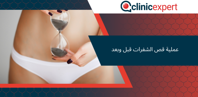 عملية قص الشفرات قبل وبعد