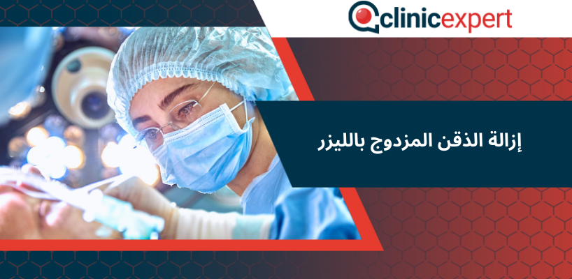 إزالة الذقن المزدوج بالليزر