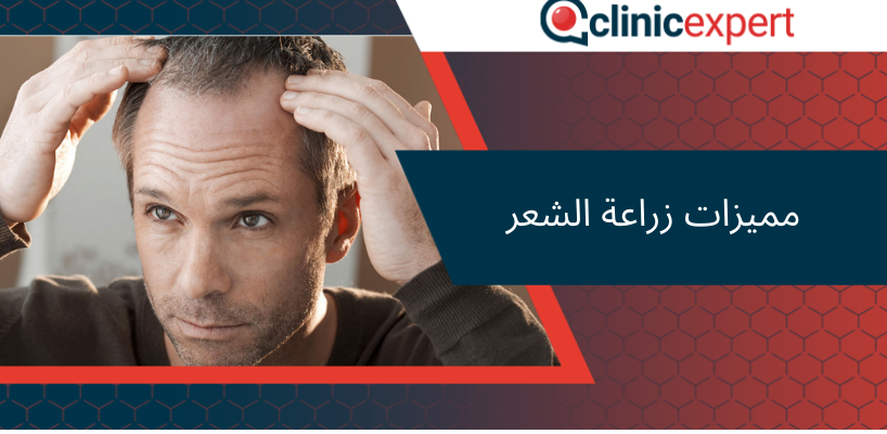 مميزات زراعة الشعر