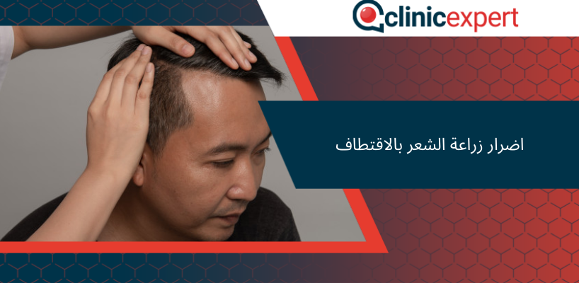 اضرار زراعة الشعر بالاقتطاف