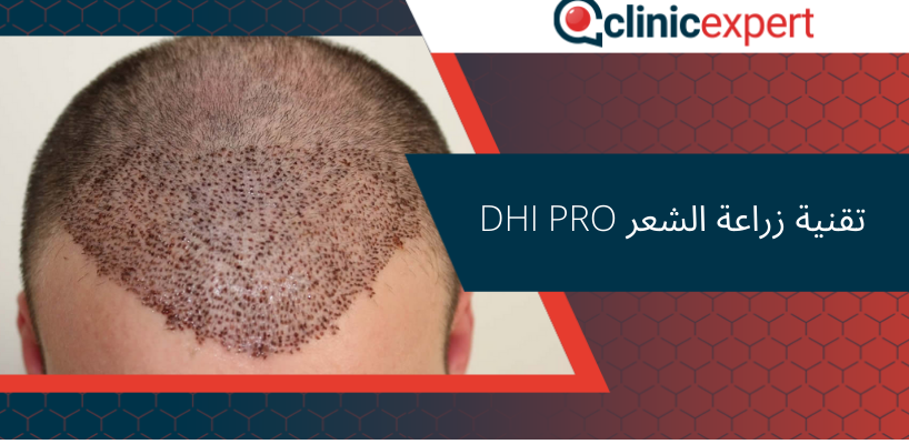 تقنية زراعة الشعر DHI PRO
