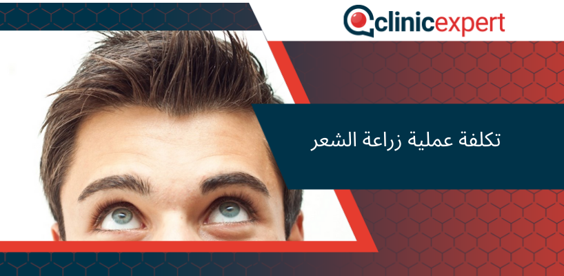 تكلفة عملية زراعة الشعر