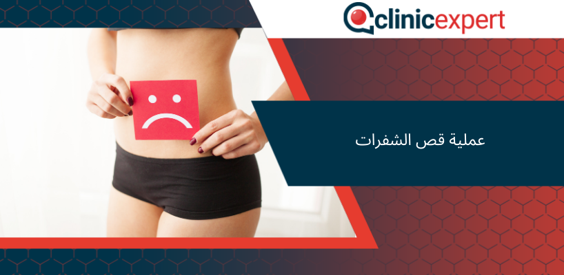 عملية قص الشفرات