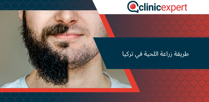 طريقة زراعة اللحية في تركيا