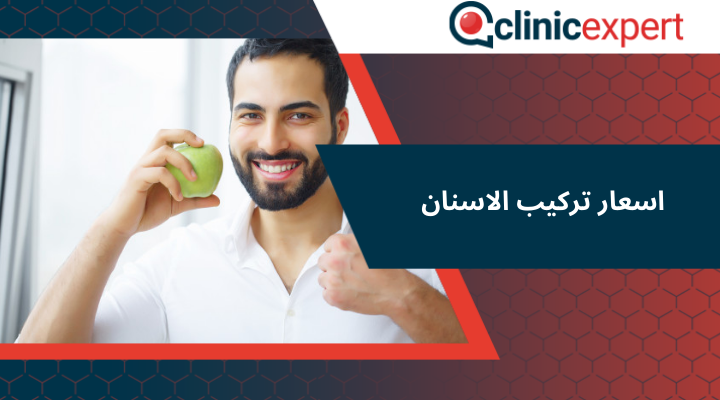 اسعار تركيب الاسنان