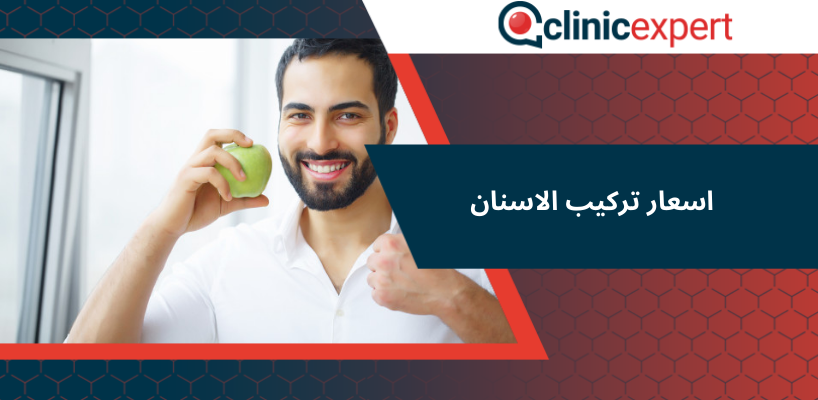 اسعار تركيب الاسنان