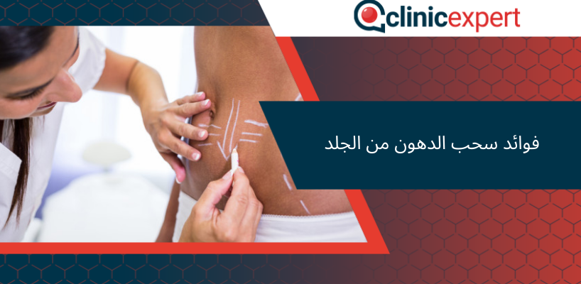 فوائد سحب الدهون من الجلد