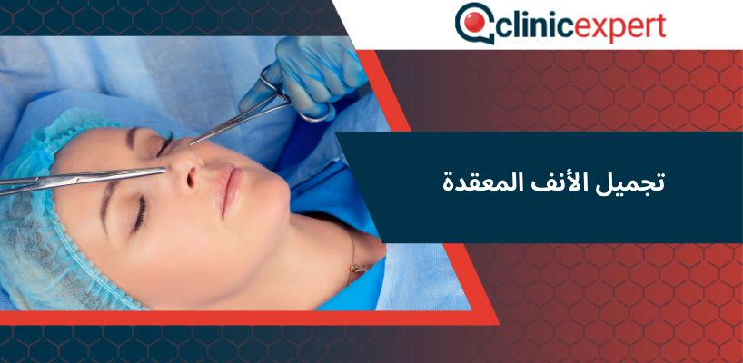 تجميل الأنف المعقدة