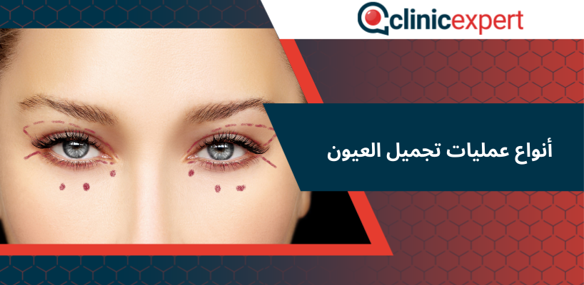 أنواع عمليات تجميل العيون