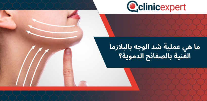 ما هي عملية شد الوجه بالبلازما الغنية بالصفائح الدموية؟