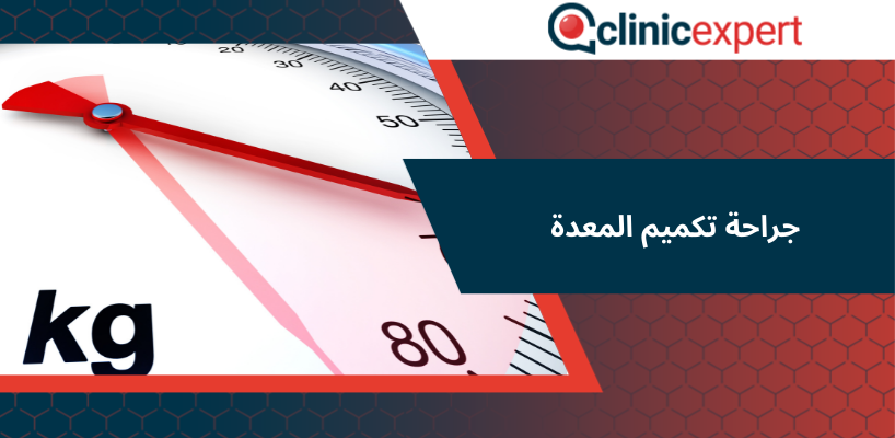 جراحة تكميم المعدة