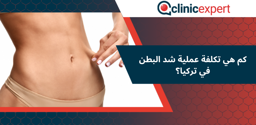 كم هي تكلفة عملية شد البطن في تركيا؟