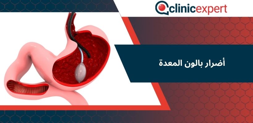 أضرار بالون المعدة